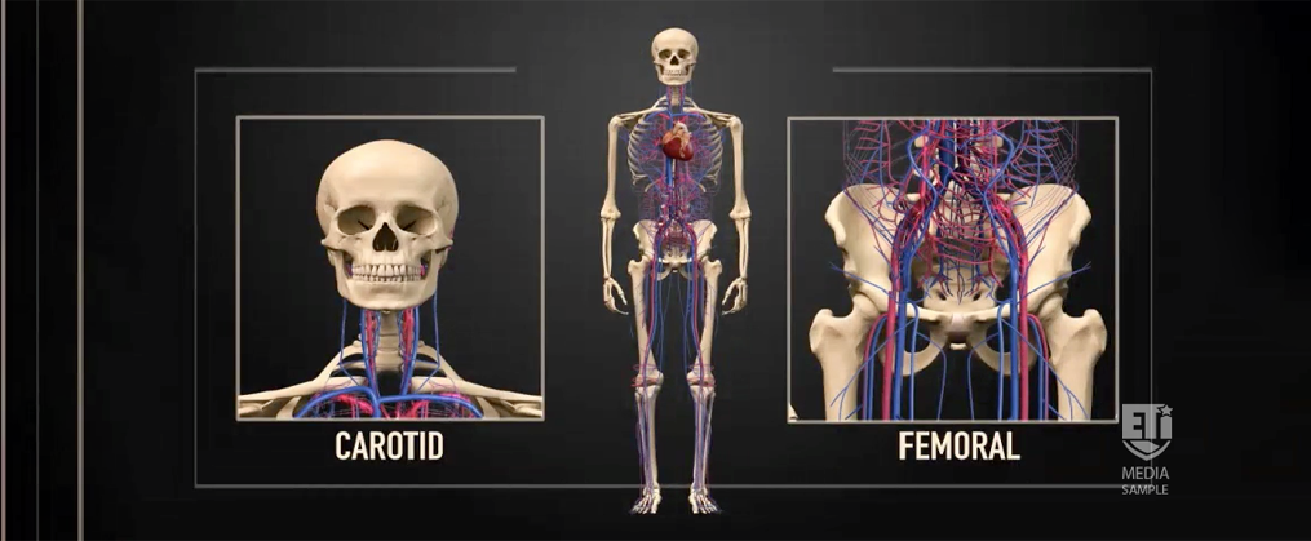 ETI human skeleton graphic